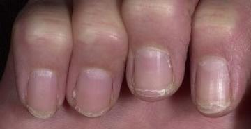 Как сделать ногти крепкими без помощи профессионала